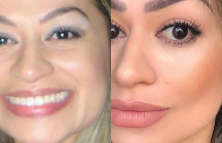 HOF DAY NA INOVATIE CLINIC: EVENTO ESPECIAL DEDICADO À HARMONIZAÇÃO OROFACIAL