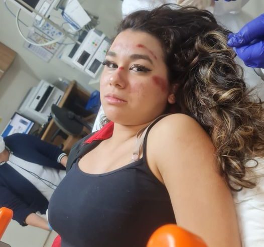 MÃE PEDE AJUDA PARA ENCONTRAR MOTOQUEIRO QUE ATROPELOU SUA FILHA NA AVENIDA ROTARY E FUGIU