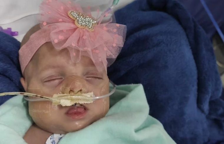 BEBÊ PREMATURO QUE NASCEU COM 440 GRAMAS EM SÃO BERNARDO SE RECUPERA APÓS LUTAR PELA VIDA EM HOSPITAL