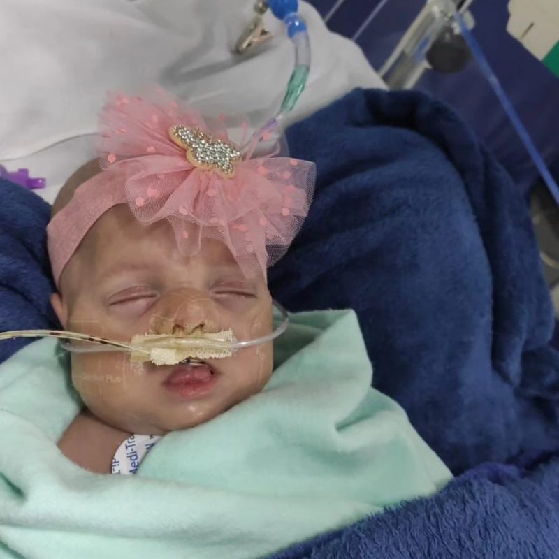 BEBÊ PREMATURO QUE NASCEU COM 440 GRAMAS EM SÃO BERNARDO SE RECUPERA APÓS LUTAR PELA VIDA EM HOSPITAL