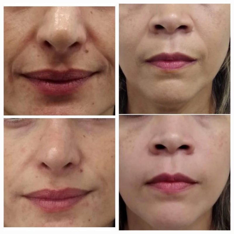 FRANQUIA DE ESTÉTICA AVANÇADA INAUGURA PRIMEIRA CLÍNICA DO ABC EM SÃO BERNARDO