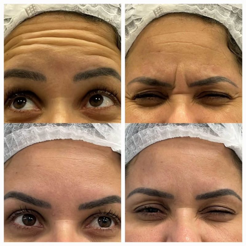 FRANQUIA DE ESTÉTICA AVANÇADA INAUGURA PRIMEIRA CLÍNICA DO ABC EM SÃO BERNARDO