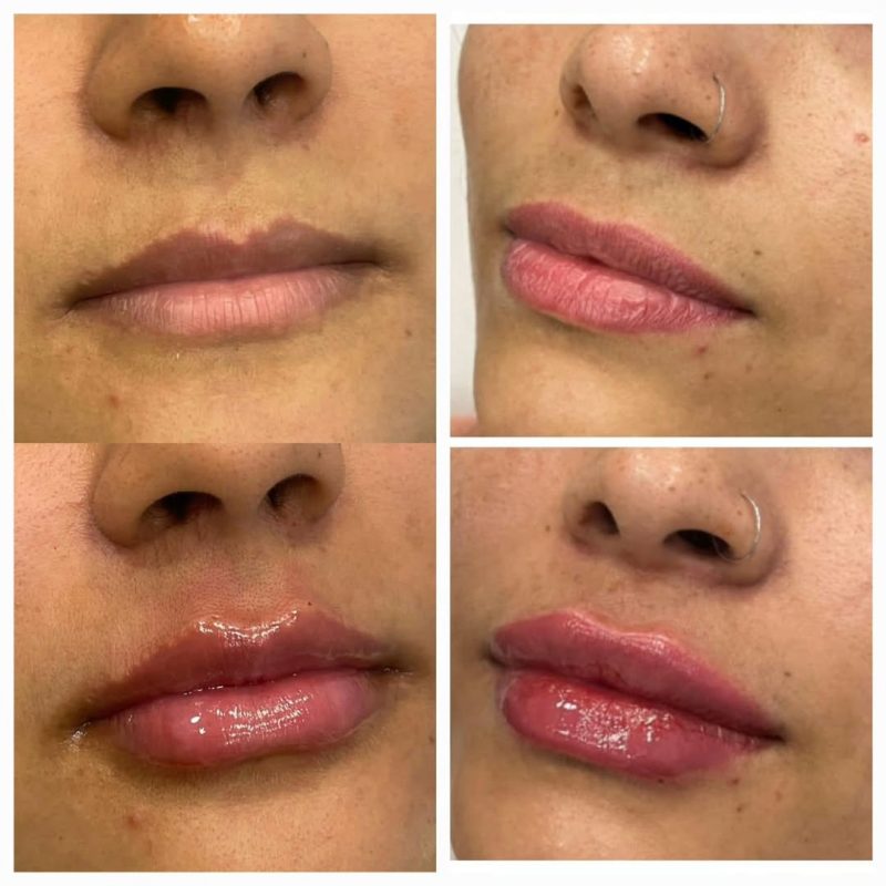 FRANQUIA DE ESTÉTICA AVANÇADA INAUGURA PRIMEIRA CLÍNICA DO ABC EM SÃO BERNARDO