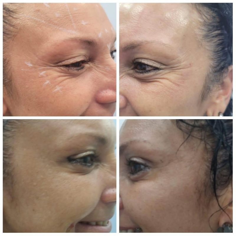 FRANQUIA DE ESTÉTICA AVANÇADA INAUGURA PRIMEIRA CLÍNICA DO ABC EM SÃO BERNARDO