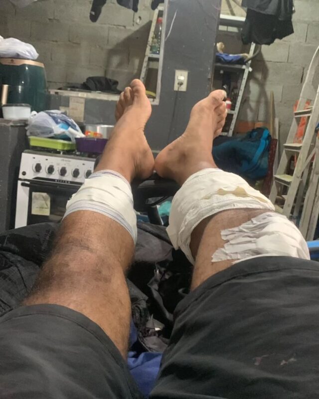 CACHORRO ABANDONADO EM SÃO BERNARDO MORDE SETE PESSOAS NO IRAJÁ