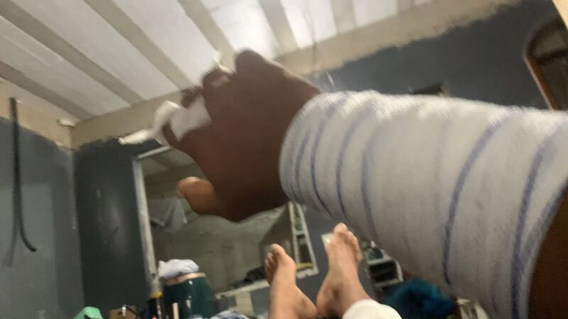 CACHORRO ABANDONADO EM SÃO BERNARDO MORDE SETE PESSOAS NO IRAJÁ