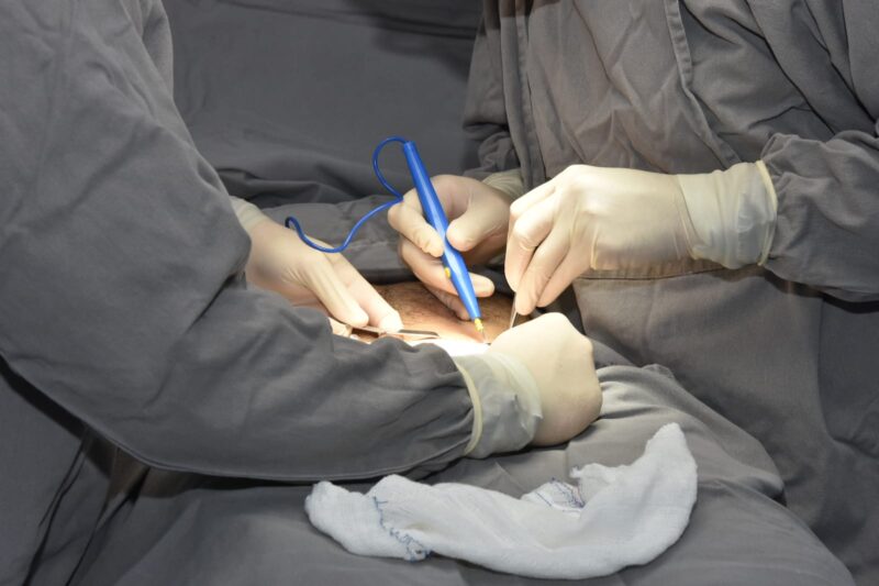 FORÇA-TAREFA DE CIRURGIAS EM SANTO ANDRÉ REALIZA 1,5 MIL PROCEDIMENTOS EM DOIS MESES