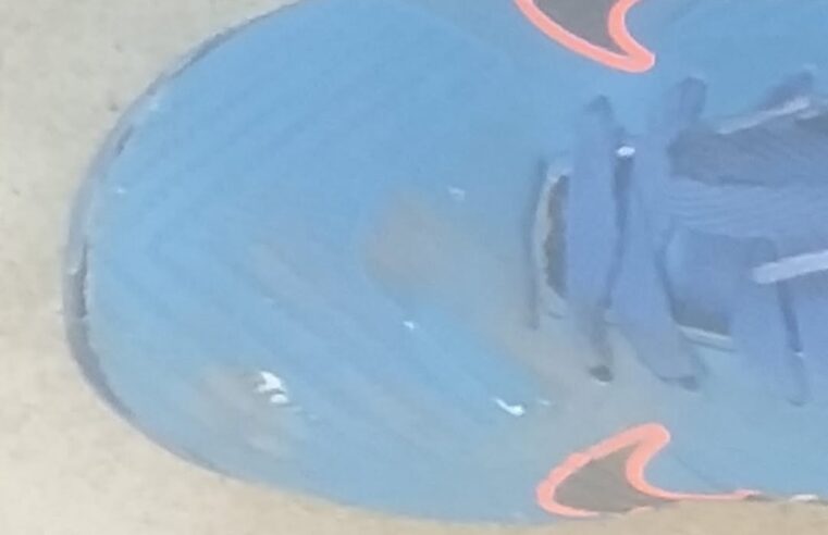 PAI PROCURA MOTORISTA QUE PASSOU COM CARRO SOBRE PÉ DE CRIANÇA DE 8 ANOS EM FRENTE A ESCOLA NA RUA DOS VIANAS; MULHER FUGIU SEM PRESTAR SOCORRO