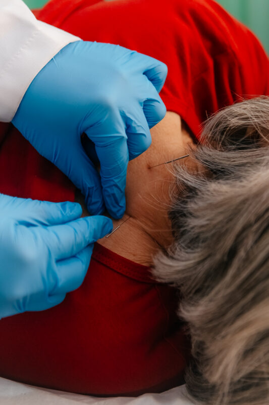 ACUPUNTURA É DIFERENCIAL DA REDE DE SÃO BERNARDO COMO TRATAMENTO AUXILIAR PARA DORES CRÔNICAS