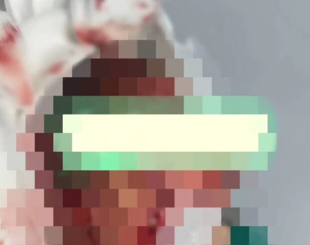 IDOSO DE 65 ANOS É ATACADO POR PITBULL EM SÃO BERNARDO, PASSA POR CIRURGIA E ESTÁ NA UTI