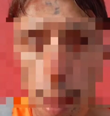 JOVEM QUE TEVE A TESTA TATUADA COM “EU SOU LADRÃO E VACILÃO” É PRESO POR TENTAR FURTAR LAVADORA DE ALTA PRESSÃO DE UBS EM DIADEMA