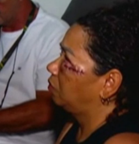 MÃE DE VÍTIMA DE FEMINICÍDI0 EM DIADEMA RECEBE ALTA HOSPITALAR; VÍDEO MOSTRA MOMENTO EM QUE CARRO DE AGRESSOR FOI LOCALIZADO