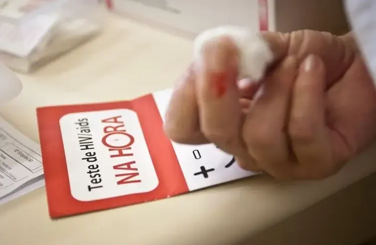 BRASIL REALIZA 1,8 MILHÃO DE TESTES DE HIV EM 2025, APONTA ABRAMED