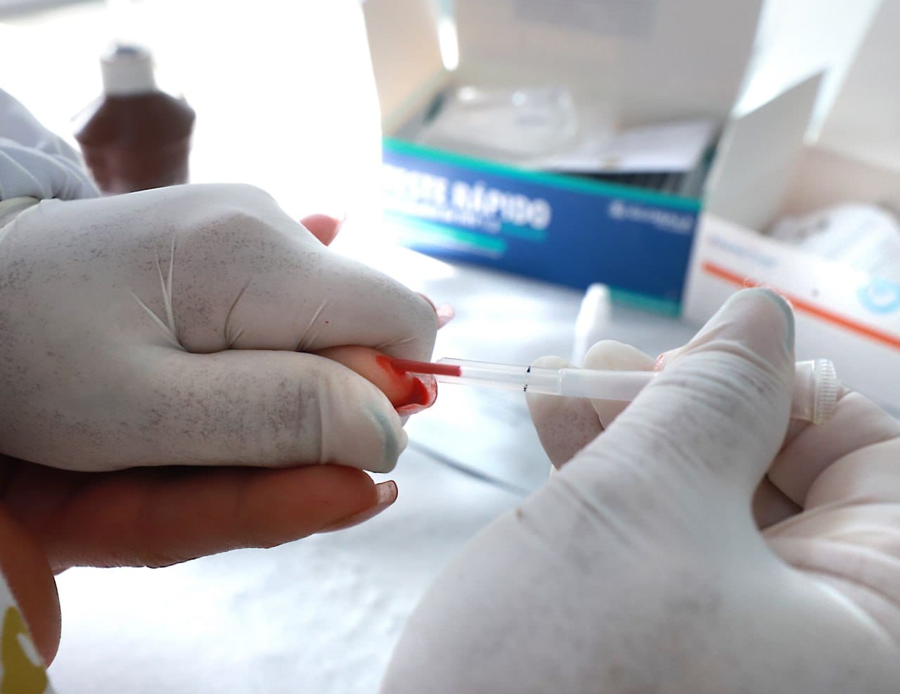 JULHO AMARELO – DIADEMA INICIA MÊS DE LUTAS CONTRA AS HEPATITES VIRAIS