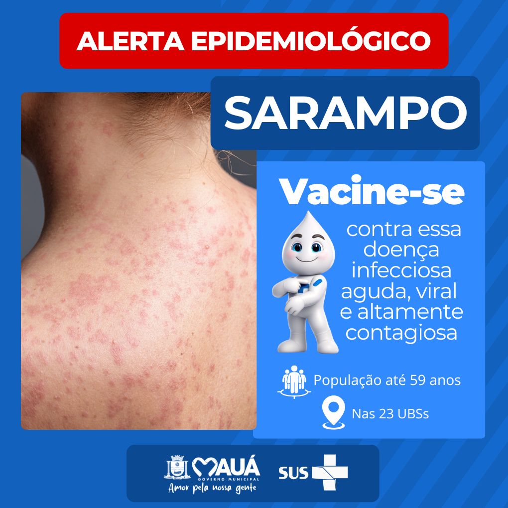MOBILIZAÇÃO CONTRA O SARAMPO É ANTECIPADA EM MAUÁ