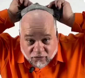CABELO NOVO, VIDA NOVA: CANDIDATO PROMETE DAR ‘TCHAU’ PARA A CARECA COM PERUCA VIA SUS